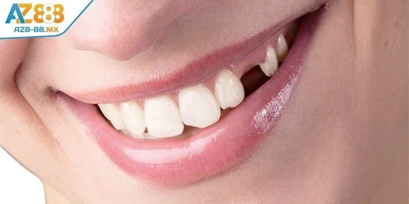 Mơ thấy răng bị rụng cửa